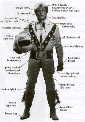 ekinjuries5.jpg